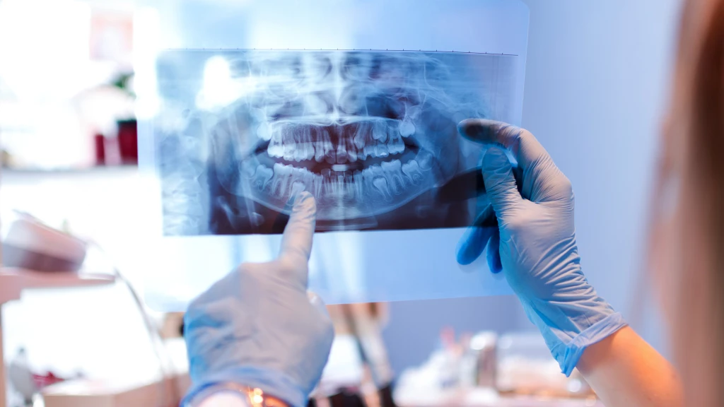 radiographie panoramique lors du premier rendez-vous orthodontiste