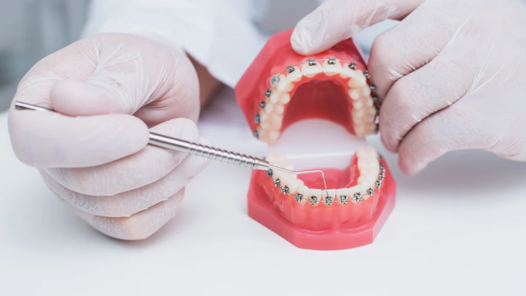 appareils orthodontique - verviers - orthodontiste 