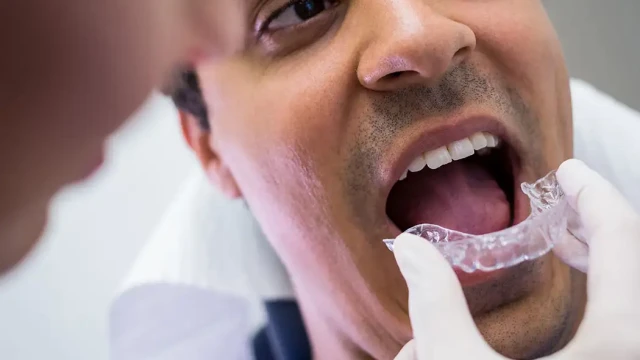 Orthodontie pour adultes
