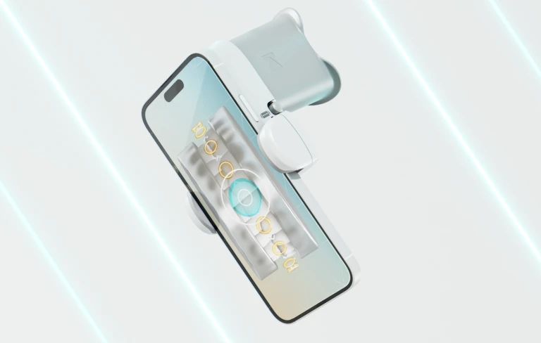dental monitoring - solution de surveillance de l'evolution