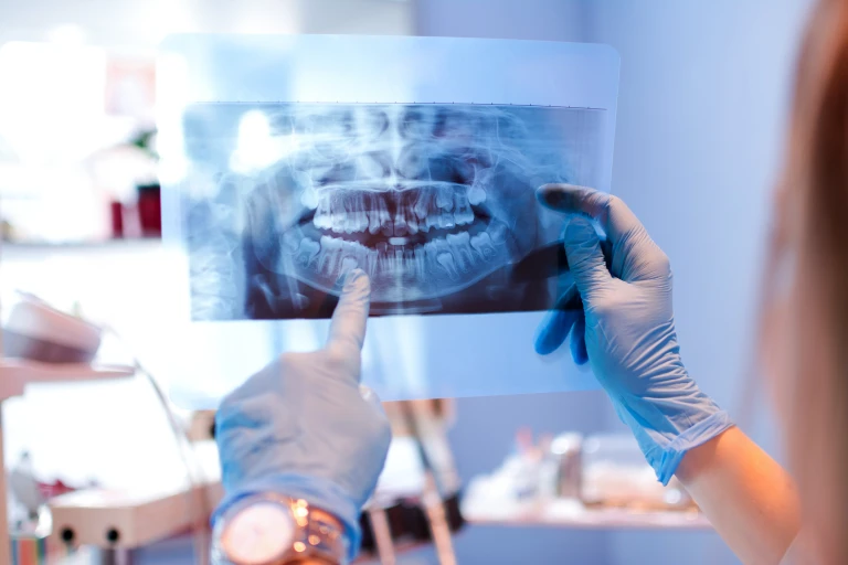 radiographie panoramique lors du premier rendez-vous orthodontiste
